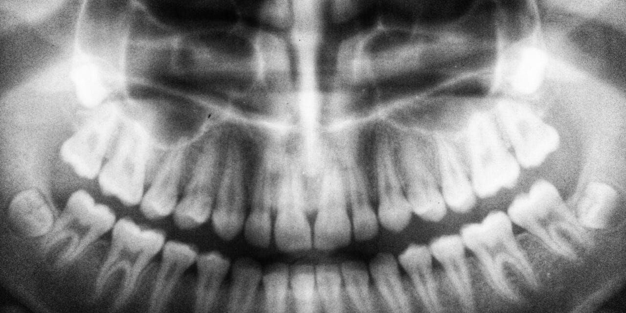 How Much Are Dental X-Rays? Costs and Importance Explained