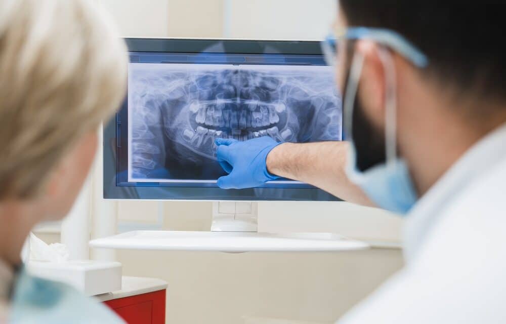 How to Know If You Need a Root Canal